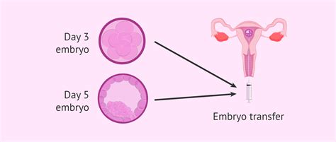 3 embriyo transfer edilenler